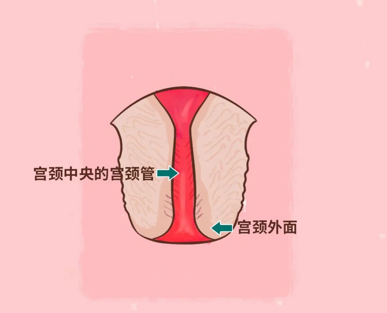 宫颈为何爱生病？4 个保护宫颈的方法，女生都该了解