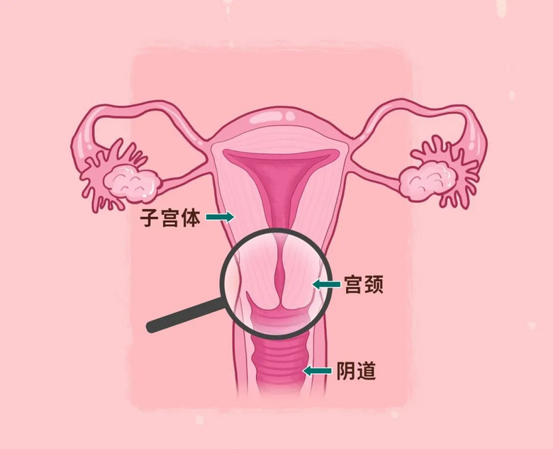 宫颈为何爱生病？4 个保护宫颈的方法，女生都该了解