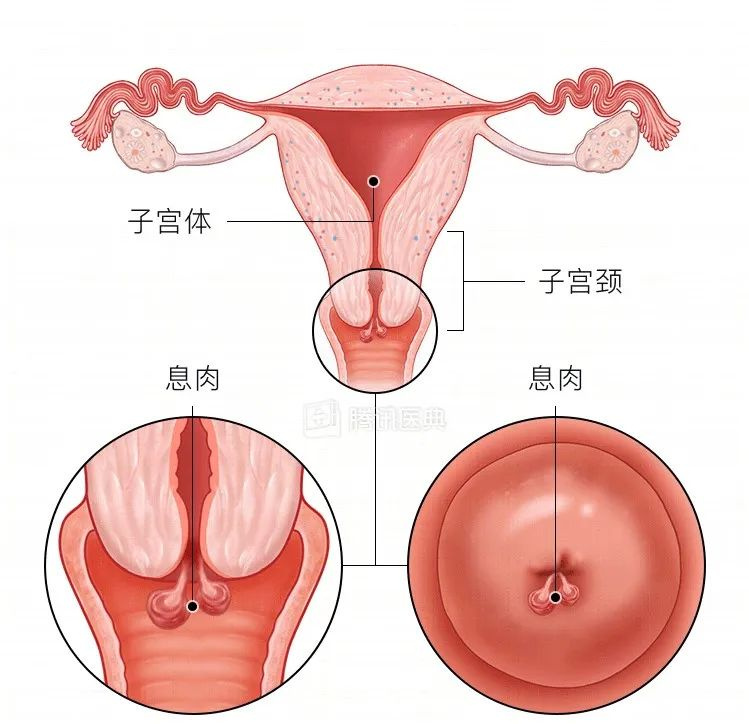 宫颈为何爱生病？4 个保护宫颈的方法，女生都该了解