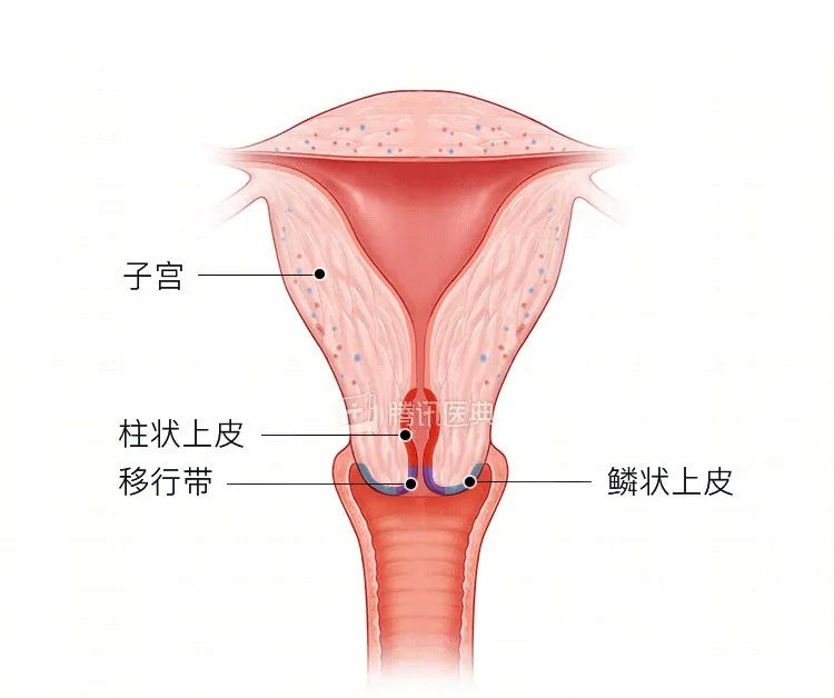 宫颈为何爱生病？4 个保护宫颈的方法，女生都该了解